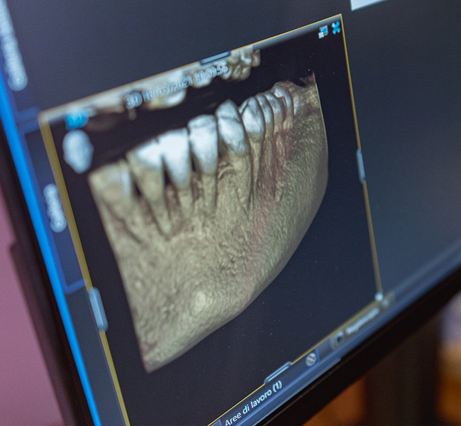 Tac Cone Beam radiologia diagnostica - Studio dentistico Nicosia Palermo